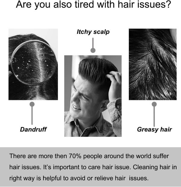 Scalp Massager, Electric Scalp Massage Brush, Hair Massage Brush, Electric Head Scratcher, Massage Comb with Soft Rubber